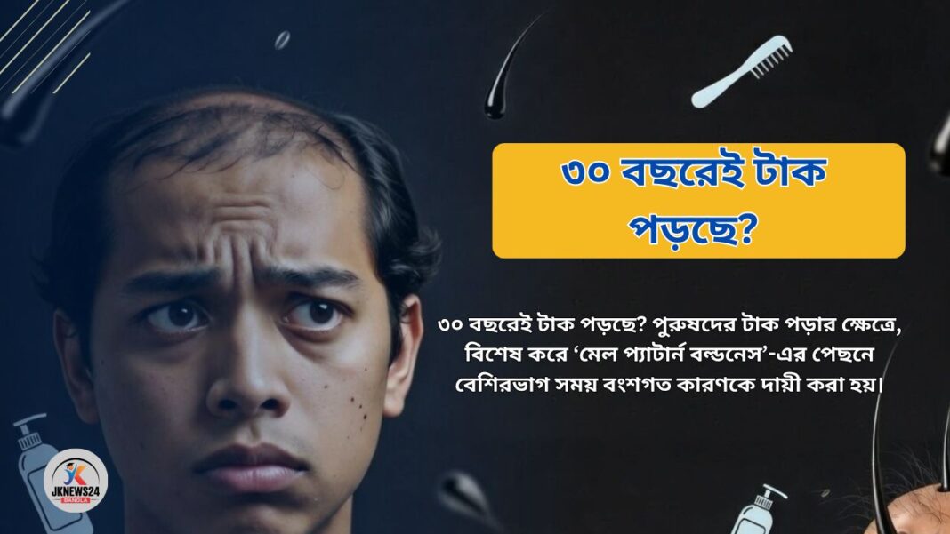 ৩০ বছরেই টাক পড়ছে?