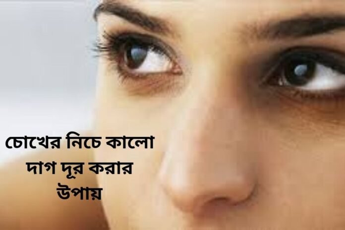 চোখের নিচে কালো দাগ দূর করার উপায়
